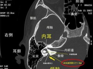 耳部结构